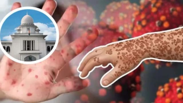 হামে মৃত ৩৫২ শিশুর পরিবারকে ২ কোটি টাকা করে ক্ষতিপূরণ দিতে রিট